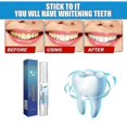 thumbnail image 4 of Beauty Tooth Pen Teeth Oral Care To Remove Yellow Teeth Teeth To Yellow And Black Clean Teeth Pen Beauty Tooth Pen Gel, 4 of 5