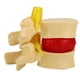 thumbnail image 5 of Modelo De Hernia De Disco Lumbar Humano, Portátil Profesional Práctico 1:1.5 Vértebras Lumbares Humanas Degenerativas, Enseñanza Clínica Para Ortopedia, 5 of 7