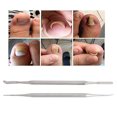 thumbnail image 1 of Vernis d'Ongle Incarné de Fixateur d'Ongle de Fil d'Ongle d'Ongle d'Ongle d'Ongle d'Ongle d'Ongle d'Ongle d'Ongle d'Ongle d'Ongle d'Ongle d'Ongle d'Ongle d'Ongle d'Ongle d'Ongle d'Ongle d'Ongle d'Ongle d'Ongle, 1 of 8