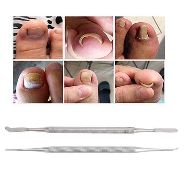 Vernis d'Ongle Incarné de Fixateur d'Ongle de Fil d'Ongle d'Ongle d'Ongle d'Ongle d'Ongle d'Ongle d'Ongle d'Ongle d'Ongle d'Ongle d'Ongle d'Ongle d'Ongle d'Ongle d'Ongle d'Ongle d'Ongle d'Ongle d'Ongle d'Ongle