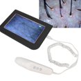 thumbnail image 2 of Dioche Wireless Skin Microscope, Rechargeable Design Hair Scalp Detector, Hair, Skin For Fingernails, 2 of 8