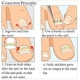 thumbnail image 3 of Nail patch, 3 of 5