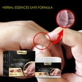 thumbnail image 4 of Elimine la picazón, la mordedura, de hierbas para manos y pies, 30G, 4 of 8