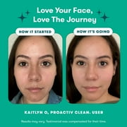 Proactiv Clean 3-Step Formula: Mineral Cleanser, Azelaic Acid Serum & Hydrating Moisturizer