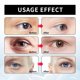 thumbnail image 5 of Crema Antiarrugas para El Contorno de Ojos, Reparadora, Reafirmante E Hidratante, 30 G | Cct250423004, 5 of 7