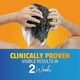 thumbnail image 4 of 2025 Nizorall Shampoo Anti Dandruff Treatment Prevents Dandruff 100 ML, 4 of 5