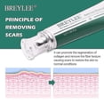 thumbnail image 5 of Breylee Acne Scar Removal Cream: 30g, Skin Repair (1pcs), 5 of 5