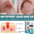 thumbnail image 5 of Curita, gel cicatrizante para heridas, transpirable e impermeable, vendaje líquido, parche para heridas, curita líquida, aerosol, pegamento hemostático para heridas, 1 pieza, 5 of 5