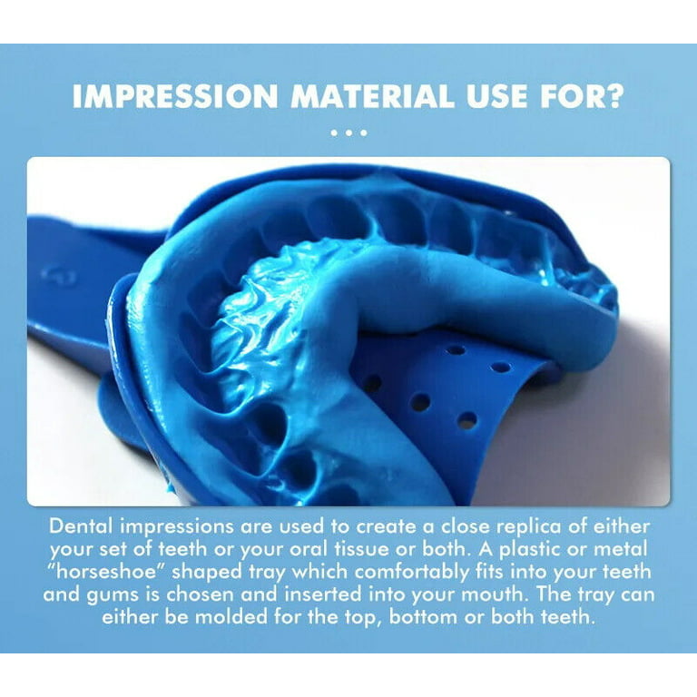 Dental Impression Kit - 168 Gm Putty Silicone - 4 Dental Trays-Upper a – OS  company