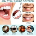 thumbnail image 4 of Tooth Paint, Teeth Whitening Gel, Instant Whitening Paint For Teeth, Tooth Polish Uptight White For Sensitive Teeth, 4 of 5