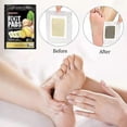 thumbnail image 2 of Cinturón corrector de postura de espalda ajustable Yuxing 2024 para mujeres y hombres, 2 of 5