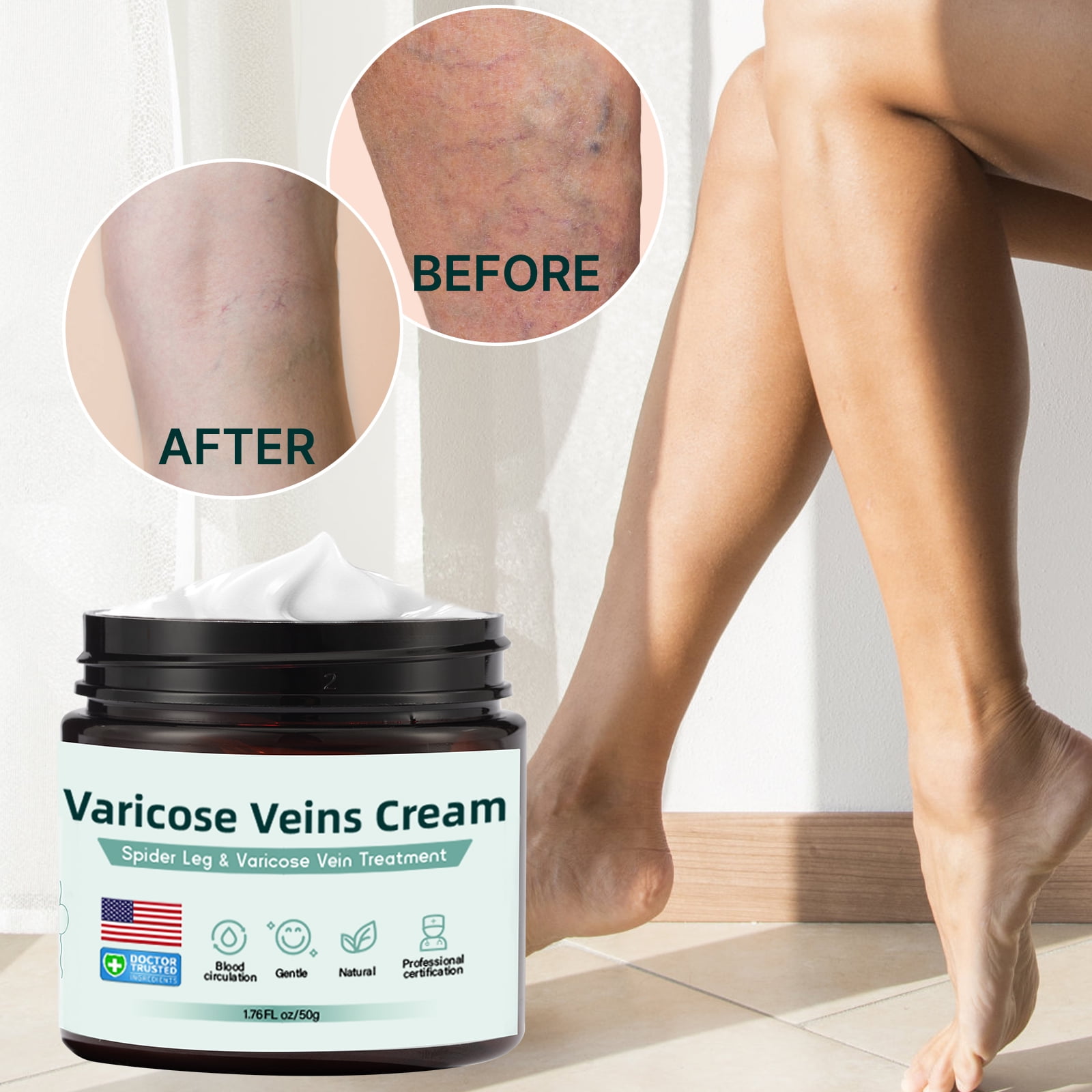 Varicose Veins Cream 1.76 fl oz || Suitable for Spider Veins, Improve Blood Circulation, Strengthen Capillary Tired and Heavy Legs Fast Relief