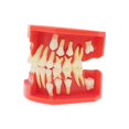 thumbnail image 1 of Dentalmall Teeth Typodonts Dental Model #7013 - Teeth Eruption Development Model Alternating Model Of Constant Pressure Of Deciduous Teeth, 1 of 4