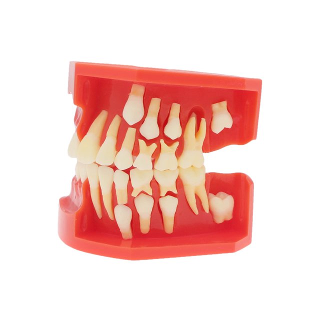 Dentalmall Teeth Typodonts Dental Model #7013 - Teeth Eruption Development Model Alternating Model Of Constant Pressure Of Deciduous Teeth