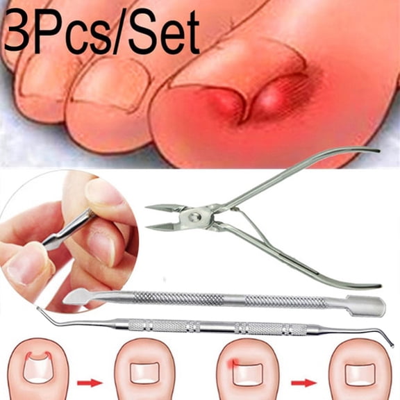 Nippers Toe Nail Clippers Set - Ingrown Nail Correction 3Pcs, Dead Skin Remover, Cuticle Cleaner, Durable Spring, Salon & Home Use, Women Men, Portable, for Sensitive Skin Easter, Makeup Organizers