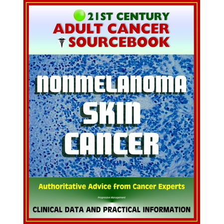 21st Century Adult Cancer Sourcebook: Nonmelanoma Skin Cancer - Squamous Cell Carcinoma and Basal Cell Carcinoma (BCC and SCC) - Clinical Data for Patients, Families, and Physicians -