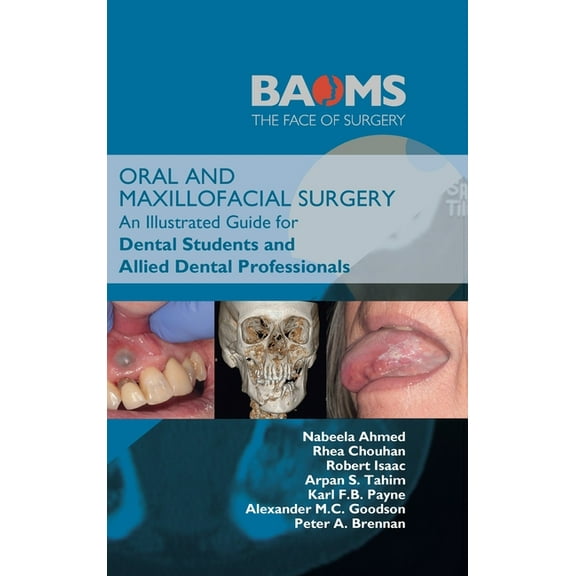 Oral and Maxillofacial Surgery: An Illustrated Guide for Dental Students and Allied Dental Professionals, (Hardcover)