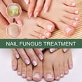 thumbnail image 4 of Nail Fungal Treatment Toenail Treatment Extra Strong Nail Repair Fingernail Fix & Renew Damaged Discolored Nails, 4 of 5