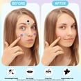 thumbnail image 4 of Pimple Patches for Face, Hydrocolloid Acne Patches, Cute Star Zit Covers, Colorful Superstar Patches Spot Stickers, 357 Count | 4 Sizes (8mm/9mm/11mm/14mm), 4 of 9