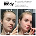 thumbnail image 2 of Sunny Teddy Timbres Anti-Boutons Ronds Transparents – Timbre Anti-Acné Hydrocolloïde avec Acide Salicylique, Invisible & Doux pour la Peau, 2 of 5