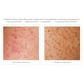 thumbnail image 4 of Glytone Exfoliating Body Lotion 8.4 fl oz / 250 ml, 4 of 4