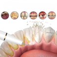 thumbnail image 2 of Plaque Remover For Teeth Teeth Cleaning Kit For Removal Of Food Residue Tartar Oral Care At Home, 2 of 3