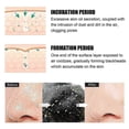 thumbnail image 3 of Blackhead Nose Patch, Blackhead Pore Strips, Deep Charcoal Pore Cleansing Strips, Nose Blackhead Remover Strips for All Ski, 3 of 5