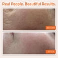 thumbnail image 4 of Serum YEOUTH Sérum facial con vitamina C y ácido hialurónico 60 ml, 4 of 7