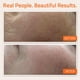 thumbnail image 4 of Serum YEOUTH Sérum facial con vitamina C y ácido hialurónico 60 ml, 4 of 7