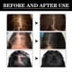 thumbnail image 5 of 1-3pcs Allurium Hair Growth Serum for Black Women, 2023 New Allurium Hair Growth Serum, 5 of 5