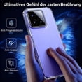 thumbnail image 3 of SharkTRUE Transparent Anti-Fall TPU Phone Case, Precise Fit, Raised Lens, Two Styles, Long-Lasting, 3 of 8