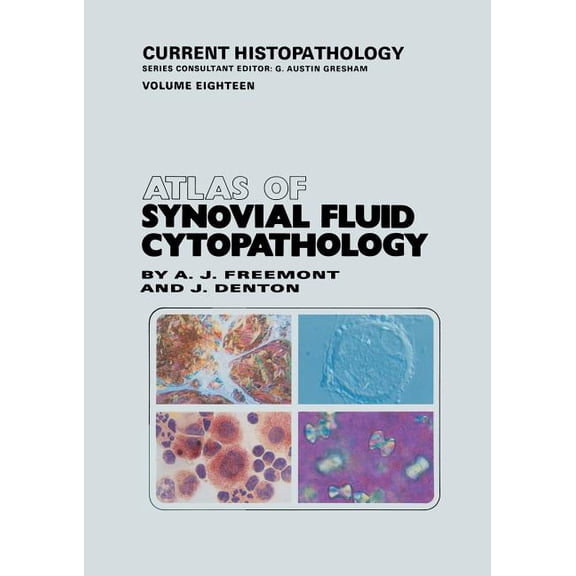Current Histopathology Atlas of Synovial Fluid Cytopathology, Book 18, (Paperback)