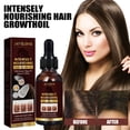 thumbnail image 4 of Solución nutritiva natural para el cabello de aceite de coco para el crecimiento del cabello de 30 ml para el cuidado de las mujeres y los hombres, 4 of 9