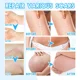 thumbnail image 4 of La eliminación de cicatrices y belleza de las mujeres mantiene la cara hidratada y repara la piel dañada, reparación postoperatoria de cicatrices, 4 of 5