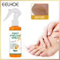 thumbnail image 1 of Foot Peeling Spray Aceite esencial de naranja Exfoliante Peel Removedor de piel muerta Ygjytge Cuidado Belleza, 1 of 9