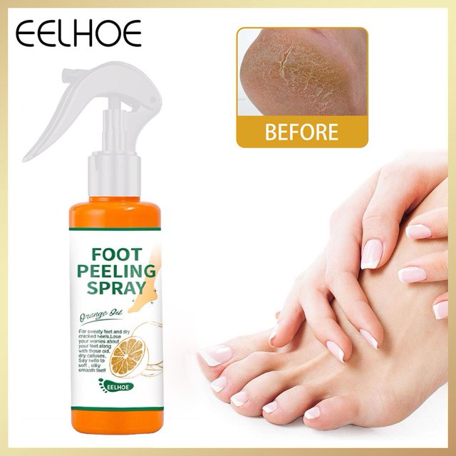 Foot Peeling Spray Aceite esencial de naranja Exfoliante Peel Removedor de piel muerta Ygjytge Cuidado Belleza