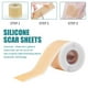 thumbnail image 5 of Cintas de tratamiento de hojas para cicatrices / Eliminación de cicatrices / Cinta de silicona suave de silicona suave de grado profesion para Salvador Silicona suave, 5 of 8