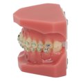 thumbnail image 4 of Modelo de soporte de ortodoncia dental, Modelo de demostración de ortodoncia dental Modelo de soporte de ortodoncia Modelo de demostración de ortodoncia Innovación moderna, 4 of 8