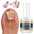 thumbnail image 3 of Aceite fortalecedor de uñas con queratina para un crecimiento de 3 días, sérum para el tratamiento de cutículas y uñas dañadas y descamadas., 3 of 5