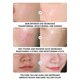 thumbnail image 4 of Mascarillas faciales Cuidado de la piel Colágenos Lámina Reducción de arrugas Hidratante Mascarilla hidratante Suave Mejora Secado Reparación 25 ml Mascarillas faciales, 4 of 5