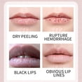 thumbnail image 4 of HKEJIAOI Deep Moisturizing Lip Balm - Long-lasting Hydration, Intensive Repair for Dry Cracked Lips with Soothing Protection, Ideal for Travel and Daily Use, 4 of 8