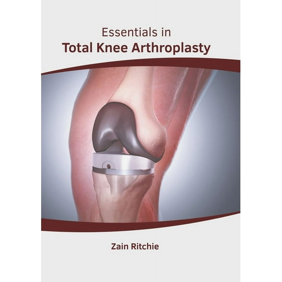 Essentials In Total Knee Arthroplasty, (Hardcover)