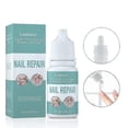 thumbnail image 1 of Fungal Nail Solution for Toenails - Fixes Discolored Nails, Safe & Effective - Anti Fungus Oil for Ingrown Toenails, 1 of 5