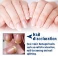 thumbnail image 2 of Tratamiento herbal para hongos en las uñas: repara las uñas grises, amarillas y engrosadas y promueve un crecimiento saludable., 2 of 4