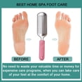 thumbnail image 4 of Lima para pies, exfoliante de pies desmontable de acero inoxidable, removedor de durezas para pies húmedos y secos, color rosa, 4 of 5