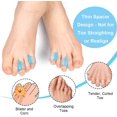 thumbnail image 3 of Gel Toe Separators,10 Pack Pinky Toe Spacers For Overlapping Toes, Bunions, Big Toe Alignment,hammer Toe Straighteners, 3 of 5