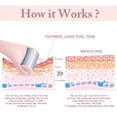 thumbnail image 4 of General Ice Roller for Face 1 Piece Stainless Steel Facial Roller Ice Face Roller for Puffiness,Migraine,Pain Relief and Skin Care (Pink), 4 of 16
