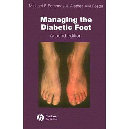 Managing the Diabetic Foot, Used [Paperback]