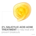 thumbnail image 3 of Limpiador facial Neutrogena, jabón para el acné sin aceite, 270 ml, paquete de 6, 3 of 8