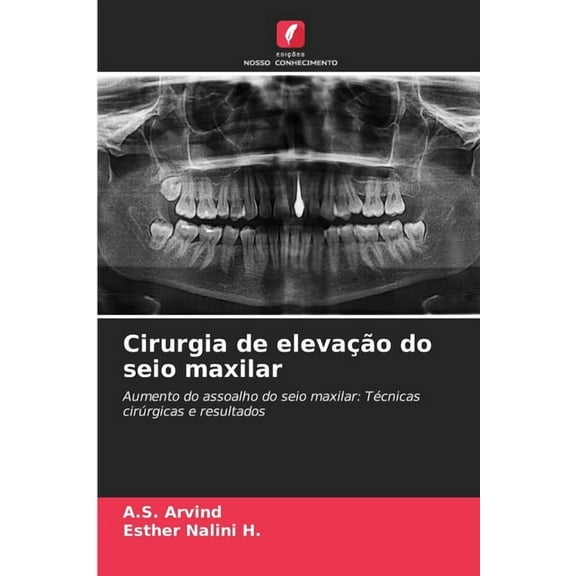 Cirurgia de elevação do seio maxilar, (Paperback)
